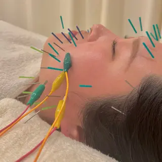 Ayaka🤍 恵比寿/美容鍼/整体のエステ・リラクイメージ