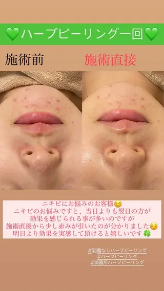 メンズ Salon de Lino 御器所のエステ・リラクイメージ