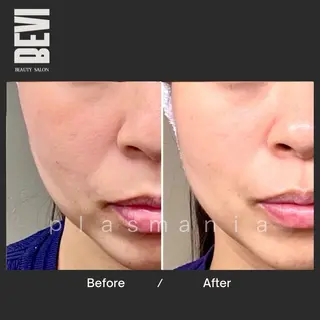 Bevi salonのその他イメージ