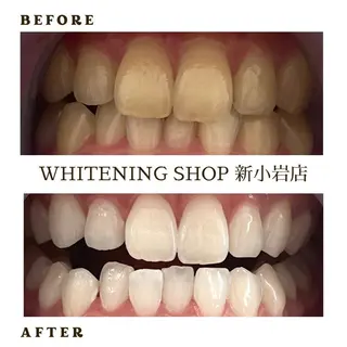 メンズ ホワイトニング ショップ新小岩店のその他イメージ