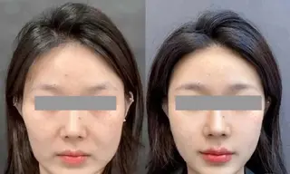 アイブロウ aliaハイフ&水光ジェットサロン所属・aliaハーブ水光店 エステティシャン募集のエステ・リラクイメージ