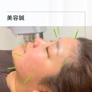 市川本八幡リーフ整骨院所属・女性のための鍼灸師 かえで𓎤𓅮のエステ・リラクイメージ