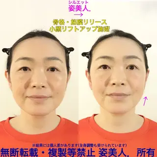 筋膜整体＆小顔矯正 　姿美人.シルエットのエステ・リラクイメージ