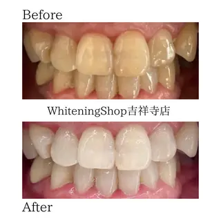 ホワイトニング ショップ吉祥寺店のエステ・リラクイメージ