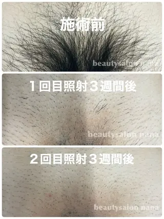 beauty salon  nana所属・beauty salon　nanaのエステ・リラクイメージ