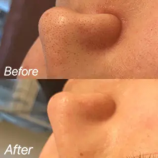 Remina clinical salon所属・ハイフ美肌専門 Remina.c.sのエステ・リラクイメージ