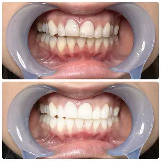 勝どきホワイトニング titti 旭花菜のその他イメージ