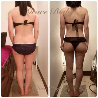 痩身・小顔・脱毛 グレイスボディのエステ・リラクイメージ