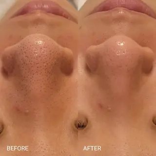 毛穴/肌管理/痩身/ ボディケア/satoのエステ・リラクイメージ