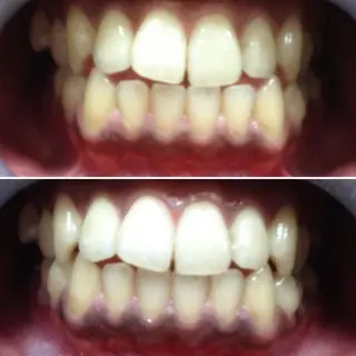 WhiteningSquare by Avanti所属・ホワイトニングスクエ ア by アバンティのその他イメージ