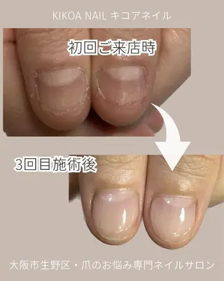 ネイル KIKOA NAIL キコアネイルのネイルデザイン