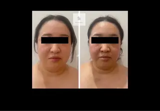 Micell beauty所属・Micell beautyのエステ・リラクイメージ