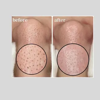 韓国肌管理 【毛穴専科】のエステ・リラクイメージ