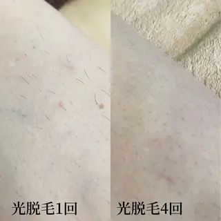 宮崎 みおのエステ・リラクイメージ