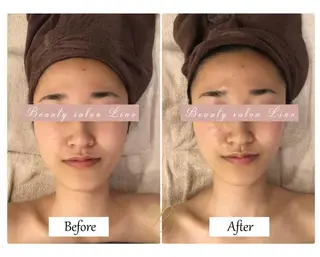 ブライダルサロン ｜Lino【堀江】のエステ・リラクイメージ