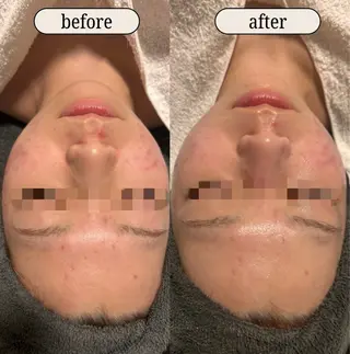 lumirise所属・lumi riseのエステ・リラクイメージ