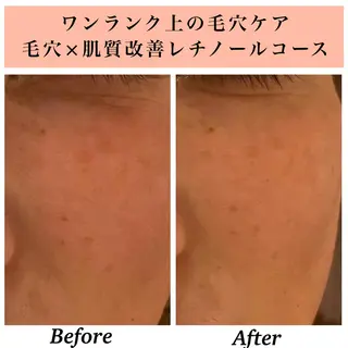 Bellesthe （ベルエステ）のエステ・リラクイメージ