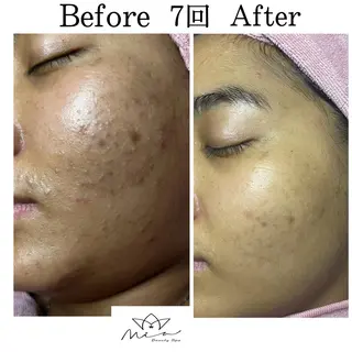 Mia beauty所属・MiA Beautyのエステ・リラクイメージ