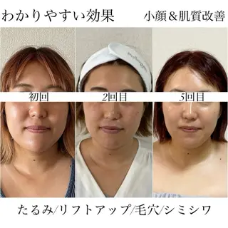 小顔＆肌質改善　お顔の印象所属・小顔×肌質改善 《お顔の印象》のエステ・リラクイメージ
