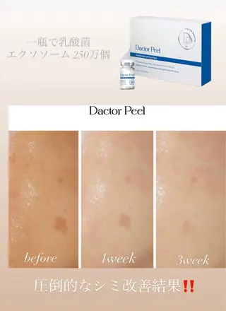 chouchou【シュシュ】所属・トータルボディケア chouchouのエステ・リラクイメージ