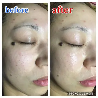 ヒーリングサロン メリッサ/tooSMILE所属・大屋 詩織のエステ・リラクイメージ