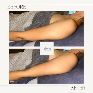 salon shares 辻堂店所属・SHARES AOIのエステ・リラクイメージ