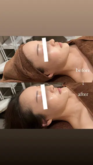 NOEL所属・フェイシャルエステ Utaiのエステ・リラクイメージ