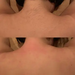 ワックス脱毛 ♡AYO♡のエステ・リラクイメージ