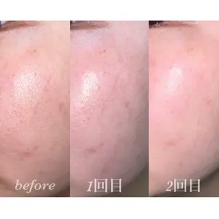 terhibur 〜テルヒブール〜のエステ・リラクイメージ