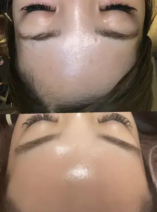 キッズ メンズ Epina 千葉店 【エピナ】のエステ・リラクイメージ