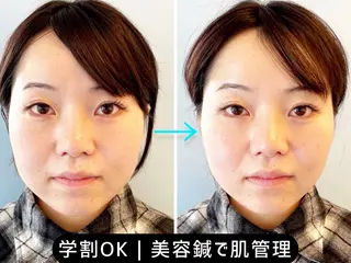 小顔美容鍼専門サロン 渋谷YZのエステ・リラクイメージ