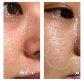 【堺市/泉ヶ丘駅】フェイシャルエステサロンSalon de jewel'm所属・Salon de jewel'm なおのエステ・リラクイメージ