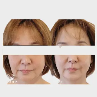 看護師 AYUIのエステ・リラクイメージ