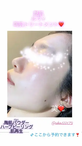 ハーブピーリング/韓国肌管理/フェイシャル/毛穴洗浄/眉毛/顔脱毛【糸脱毛専門】rev所属・ハーブピーリング🌹 毛穴洗浄❤️眉waxのエステ・リラクイメージ