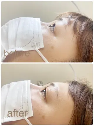 マツエク・マツパ まつげ＆ネイルANGIE【アンジー】所属・竹島 夕結のマツエク・マツパデザイン