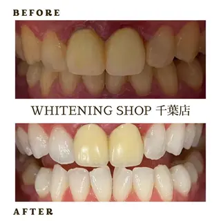 メンズ ホワイトニング ショップ千葉店のその他イメージ
