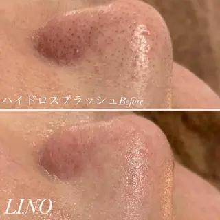 beautysalon LINO所属・平日昼間限定★ 全メニュ¥6600のエステ・リラクイメージ