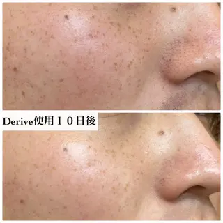 メンズ メナード岐阜市茜部 杉浦のエステ・リラクイメージ