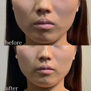 骨気&Relaxation vivian所属・VIVIAN 前田のエステ・リラクイメージ