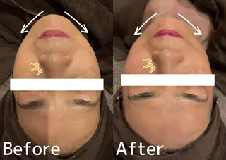 小顔美肌：ミアンカ 京阪モール本館1Fのエステ・リラクイメージ