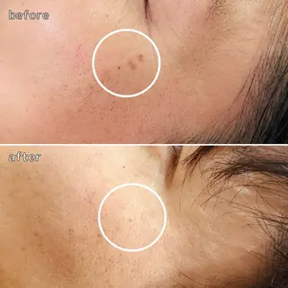 “川越で選ばれる” 🫧ニナル🫧のエステ・リラクイメージ