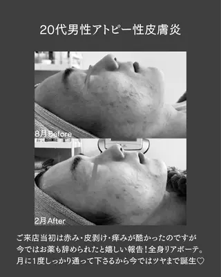 BLOSSOM 菊地のエステ・リラクイメージ