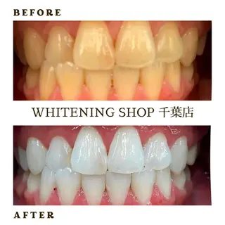 メンズ ホワイトニング ショップ千葉店のその他イメージ