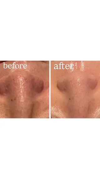 エムフルール リラク＆エステのエステ・リラクイメージ