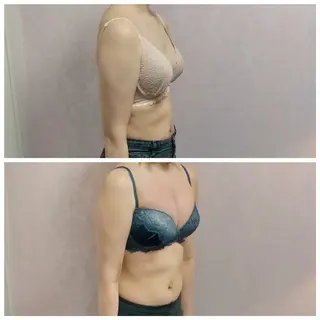 バストケアサロン toujours.bのエステ・リラクイメージ