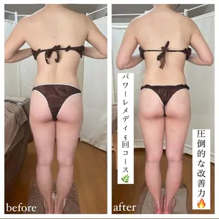 biloop所属・《痩身×疲労改善》 BILOOPのエステ・リラクイメージ