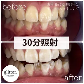 glitter.SHONAN所属・佐久間 茉弥のエステ・リラクイメージ