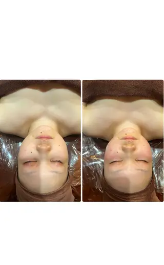 espresso,所属・《痩身、小顔専門店》 エスプレッソのエステ・リラクイメージ