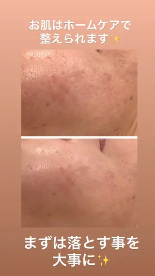 耳ツボ/体質改善/ 温活La mer月島のその他イメージ