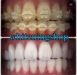 ホワイトニング ショップ千葉店のその他イメージ